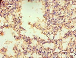 Invitrogen TR2 Polyclonal Antibody 100 μL; Unconjugated:Antibodies,