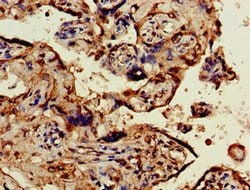Invitrogen OBSL1 Polyclonal Antibody 100 μg; Unconjugated:Antibodies,