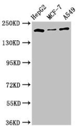 Invitrogen OBSL1 Polyclonal Antibody 100 μg; Unconjugated:Antibodies,