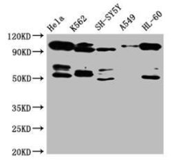 Invitrogen OFD1 Polyclonal Antibody 100 μL; Unconjugated:Antibodies,