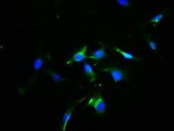Invitrogen Opsin Blue Polyclonal Antibody 100 &mu;g; Unconjugated:Antibodies,