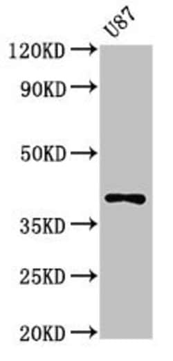 Invitrogen Opsin Blue Polyclonal Antibody 100 &mu;g; Unconjugated:Antibodies,
