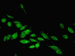 Invitrogen PARP3 Polyclonal Antibody 100 μL; Unconjugated:Antibodies,