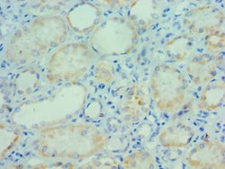 Invitrogen PARP3 Polyclonal Antibody 100 μL; Unconjugated:Antibodies,