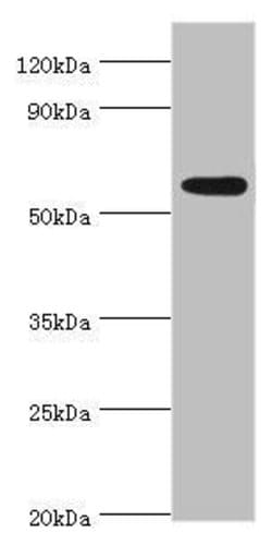 Invitrogen PARP3 Polyclonal Antibody 100 μL; Unconjugated:Antibodies,