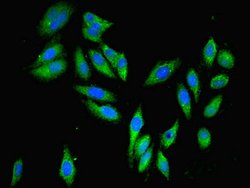 Invitrogen PARP3 Polyclonal Antibody 100 &mu;L; Unconjugated:Antibodies,