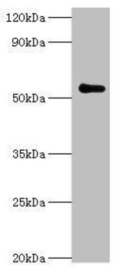 Invitrogen PARP3 Polyclonal Antibody 100 &mu;L; Unconjugated:Antibodies,