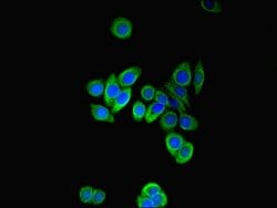 Invitrogen PFDN2 Polyclonal Antibody 100 &mu;g; Unconjugated:Antibodies,