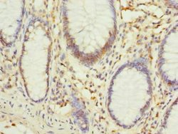 Invitrogen PHF10 Polyclonal Antibody 100 &mu;g; Unconjugated:Antibodies,