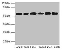 Invitrogen PHF10 Polyclonal Antibody 100 &mu;g; Unconjugated:Antibodies,