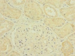 Invitrogen PLXNB2 Polyclonal Antibody 100 &mu;L; Unconjugated:Antibodies,