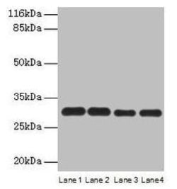 Invitrogen PMM1 Polyclonal Antibody 100 &mu;g; Unconjugated:Antibodies,