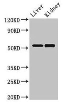 Invitrogen&trade;&nbsp;PNLIPRP3 Polyclonal Antibody