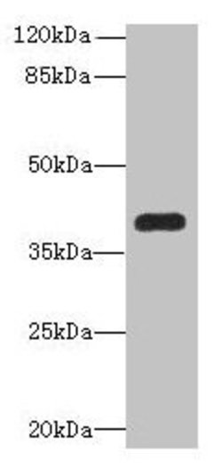 Invitrogen PNMA1 Polyclonal Antibody 100 μg; Unconjugated:Antibodies,