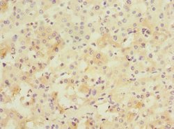 PPM1D Polyclonal Antibody:Antibodies, Polyclonal