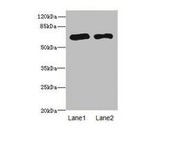 PPM1D Polyclonal Antibody:Antibodies, Polyclonal