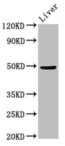Invitrogen PPM1F Polyclonal Antibody 100 &mu;g; Unconjugated:Antibodies,