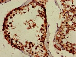 Invitrogen PPOX Polyclonal Antibody 100 μg; Unconjugated:Antibodies,