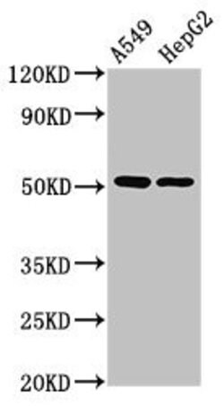 Invitrogen PPOX Polyclonal Antibody 100 μg; Unconjugated:Antibodies,