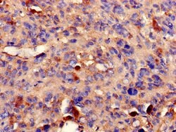 Invitrogen PPP2R2A Polyclonal Antibody 100 &mu;g | Buy Online | Invitrogen&trade; | Fisher Scientific