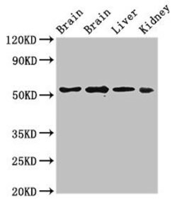 Invitrogen PPP2R2A Polyclonal Antibody 100 &mu;g | Buy Online | Invitrogen&trade; | Fisher Scientific
