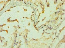 Invitrogen PPP3CC Polyclonal Antibody 100 μL; Unconjugated:Antibodies,