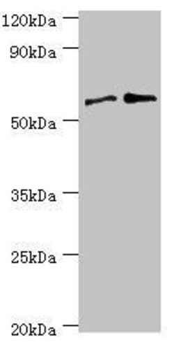 Invitrogen PPP3CC Polyclonal Antibody 100 &mu;L | Buy Online | Invitrogen&trade; | Fisher Scientific
