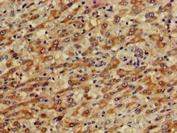 Invitrogen PRKACG Polyclonal Antibody 100 &mu;g | Buy Online | Invitrogen&trade; | Fisher Scientific