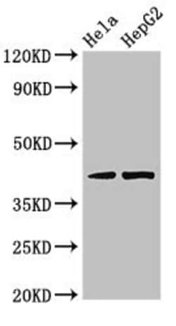 Invitrogen PRKACG Polyclonal Antibody 100 &mu;g | Buy Online | Invitrogen&trade; | Fisher Scientific