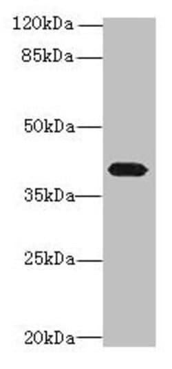 Invitrogen PTAFR Polyclonal Antibody 100 &mu;g | Buy Online | Invitrogen&trade; | Fisher Scientific