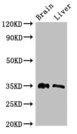 Invitrogen PTF1A Polyclonal Antibody 100 &mu;g; Unconjugated:Antibodies,