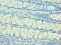 Invitrogen QARS Polyclonal Antibody 100 μL; Unconjugated:Antibodies,