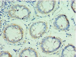 Invitrogen QARS Polyclonal Antibody 100 μL; Unconjugated:Antibodies,