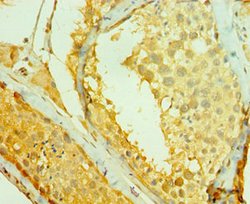 Invitrogen RAD1 Polyclonal Antibody 100 &mu;L; Unconjugated:Antibodies,