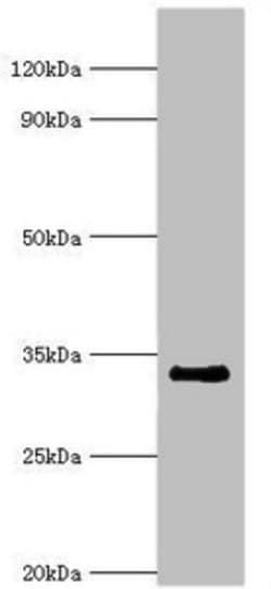 Invitrogen RAD1 Polyclonal Antibody 100 &mu;L; Unconjugated:Antibodies,