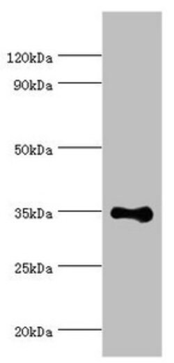 Invitrogen RAD51D Polyclonal Antibody 100 &mu;L; Unconjugated:Antibodies,