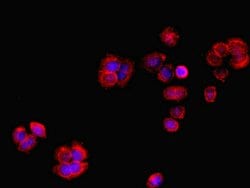 Invitrogen RCBTB2 Polyclonal Antibody 100 μg; Unconjugated:Antibodies,
