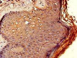 Invitrogen RCBTB2 Polyclonal Antibody 100 μg; Unconjugated:Antibodies,
