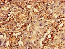 Invitrogen RCBTB2 Polyclonal Antibody 100 μg; Unconjugated:Antibodies,