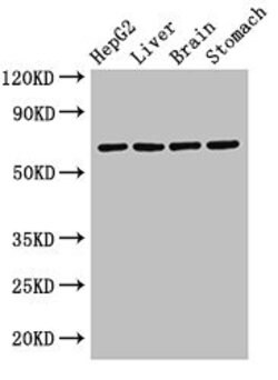 Invitrogen RCBTB2 Polyclonal Antibody 100 μg; Unconjugated:Antibodies,