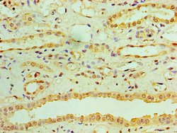 Invitrogen RDH11 Polyclonal Antibody 100 μg; Unconjugated:Antibodies,