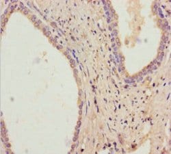 Invitrogen RDH11 Polyclonal Antibody 100 μg; Unconjugated:Antibodies,