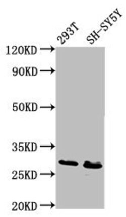 Invitrogen RFXANK Polyclonal Antibody 100 &mu;g; Unconjugated:Antibodies,