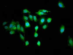 Invitrogen RGS6 Polyclonal Antibody 100 &mu;g; Unconjugated:Antibodies,