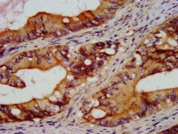 Invitrogen RGS6 Polyclonal Antibody 100 &mu;g; Unconjugated:Antibodies,