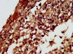 Invitrogen RGS6 Polyclonal Antibody 100 &mu;g; Unconjugated:Antibodies,