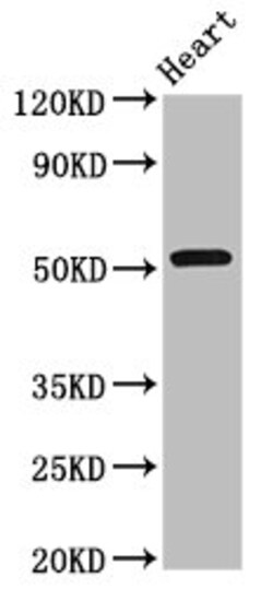 Invitrogen RGS6 Polyclonal Antibody 100 &mu;g; Unconjugated:Antibodies,