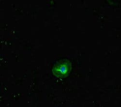 Invitrogen RHD Polyclonal Antibody 100 &mu;g; Unconjugated:Antibodies,