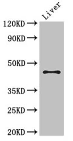 Invitrogen RHD Polyclonal Antibody 100 &mu;g; Unconjugated:Antibodies,