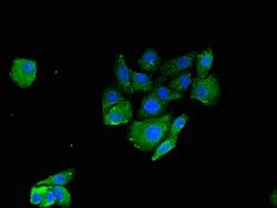Invitrogen RNF126 Polyclonal Antibody 100 &mu;g; Unconjugated:Antibodies,